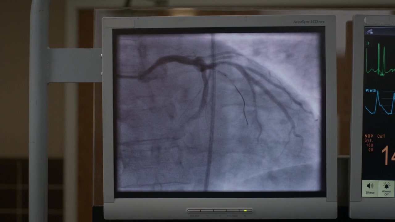 GA1411-00655.jpg