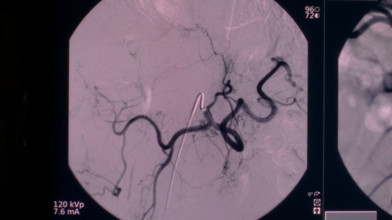 GA1416-00845.jpg