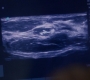 GA1418-00842.jpg