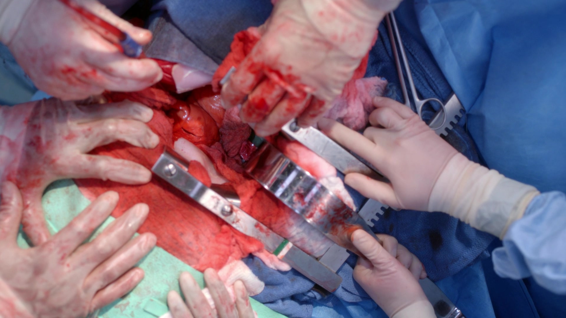 Greys_Anatomy_S19E11_1610.jpg
